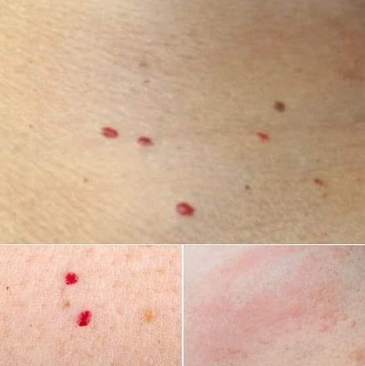 If you spot these red dots on your skin, you had better know what they mean 😮 I had no clue!