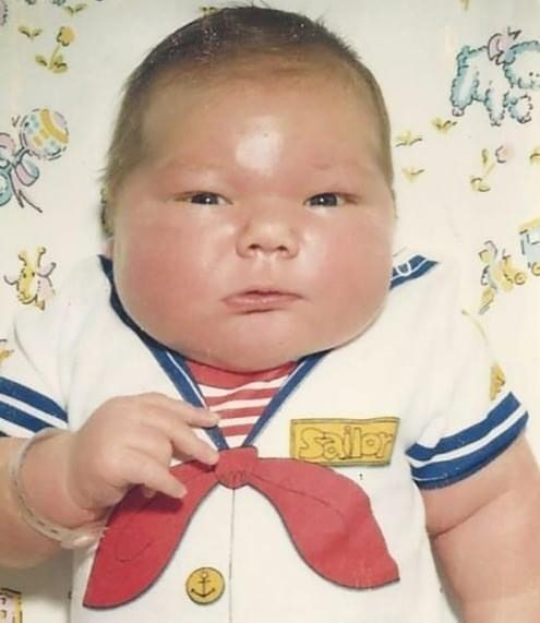 “In 1983, a 16-Pound Baby Shocked the World – You Won’t Believe What He Looks Like Now!”