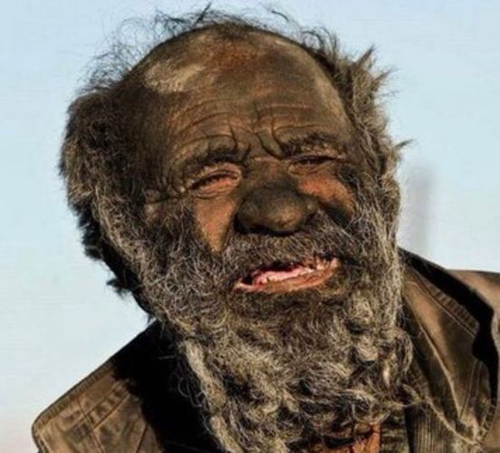 He was titled the ‘world’s dirtiest man’ after having not bathed in 67 years… when doctors ran tests on him, they were absolutely SHOCKED at what they found…